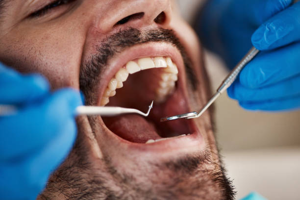 Dental Bonding in Eatonville, WA
