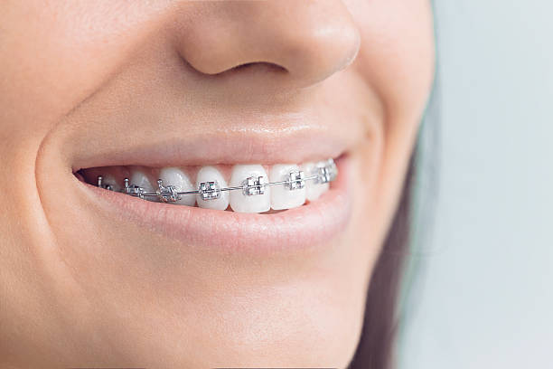 Best Traditional Braces  in Eatonville, WA